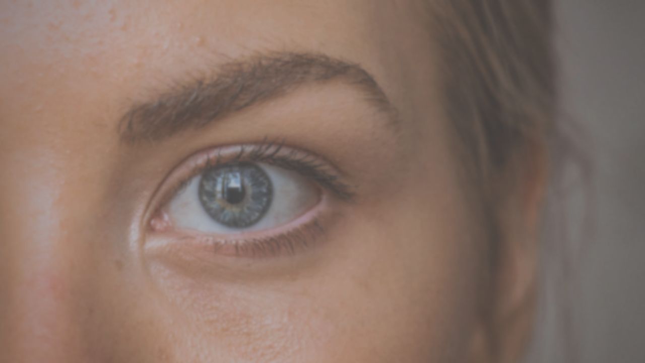 Blepharitis- Managing & Treating